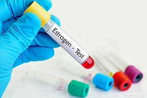 Estrogen Level Testing in Clifton, NJ