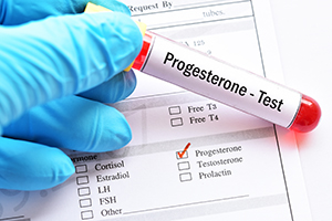 Progesterone Level Testing in Clifton, NJ